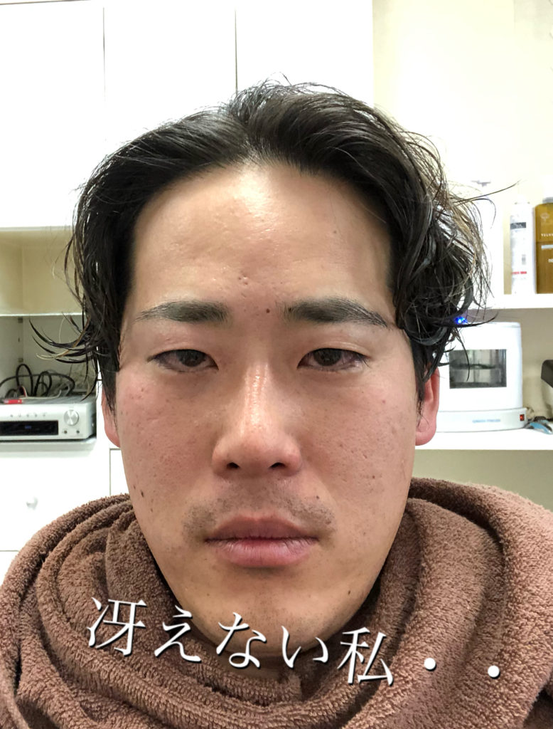 フィールでカットする前の冴えない顔の私